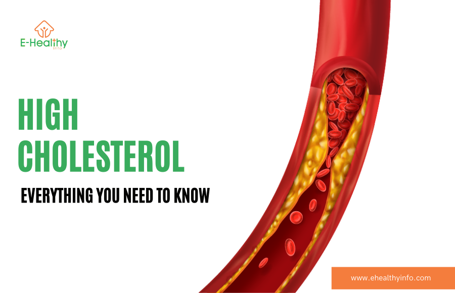 High Cholesterol Causes Symptoms And Treatment And Myths