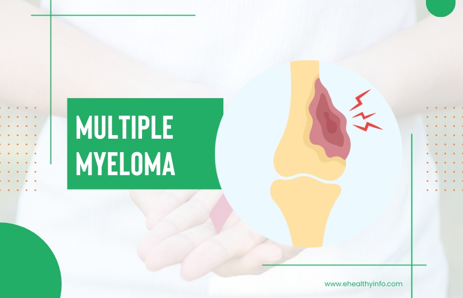 What is Multiple Myeloma? – Symptoms, Diagnosis, and Treatment