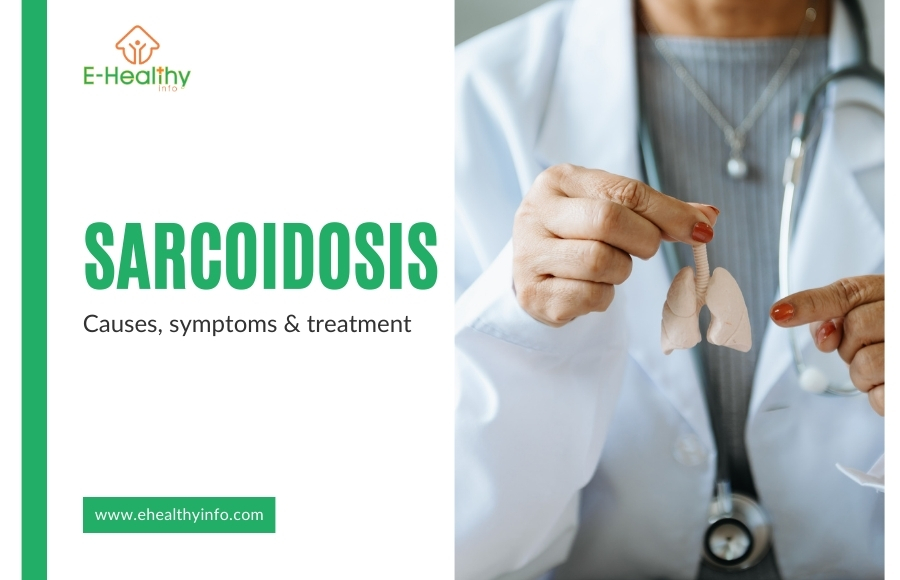 Sarcoidosis Disease: Navigating the Enigma of Symptoms and Solutions
