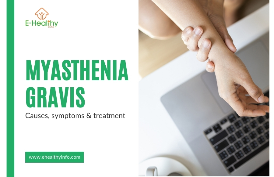 Myasthenia Gravis- Origins, Causes, and Recognizing Symptoms