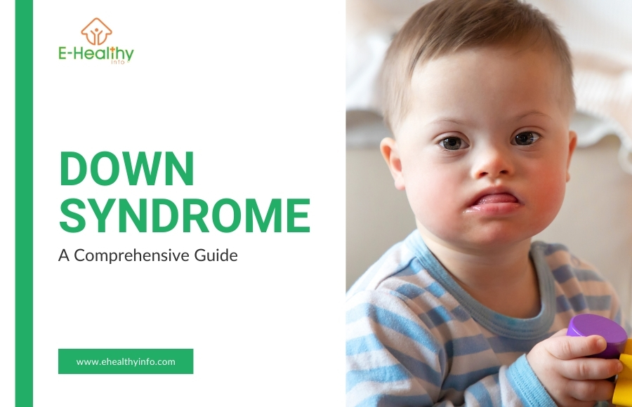 Exploring Down Syndrome: Solutions & Insights