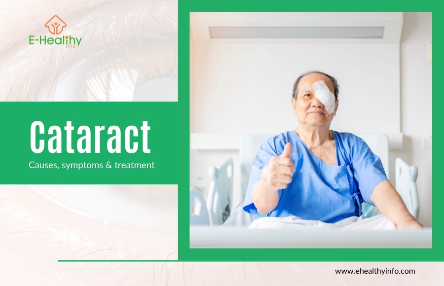 Cataracts – Uncover The Causes, Symptoms, And Modern Cataract Surgery