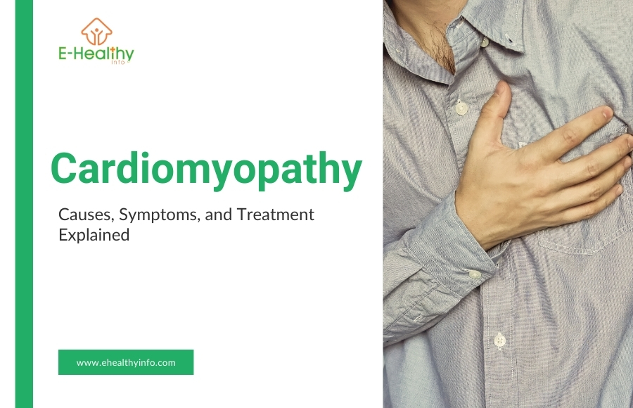 Exploring Cardiomyopathy: Causes, Symptoms, and Treatment Explained