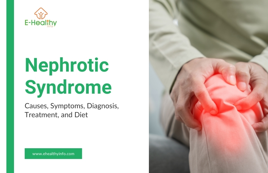 Understanding Nephrotic Syndrome: Causes, Symptoms, Diagnosis, Treatment, and Diet