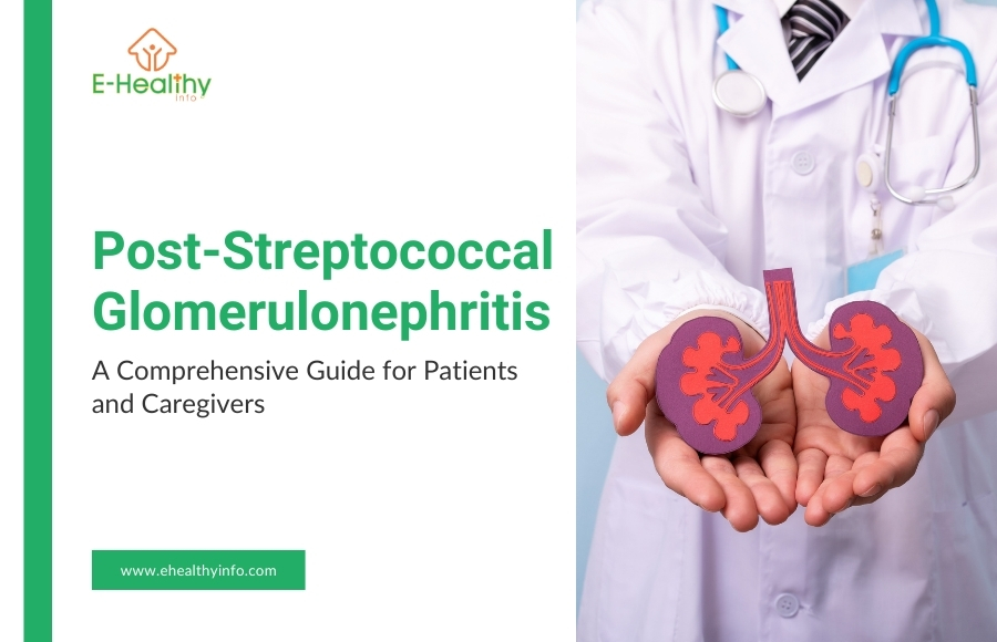 Post-Streptococcal Glomerulonephritis: A Comprehensive Guide for Patients and Caregivers