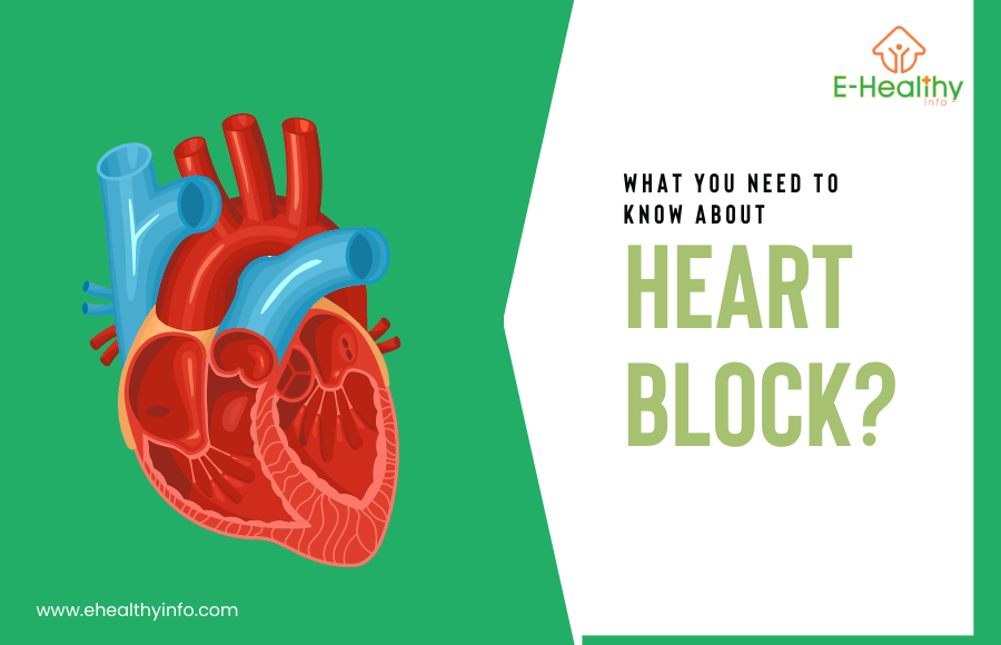 Heart block- Do you need a pacemaker?