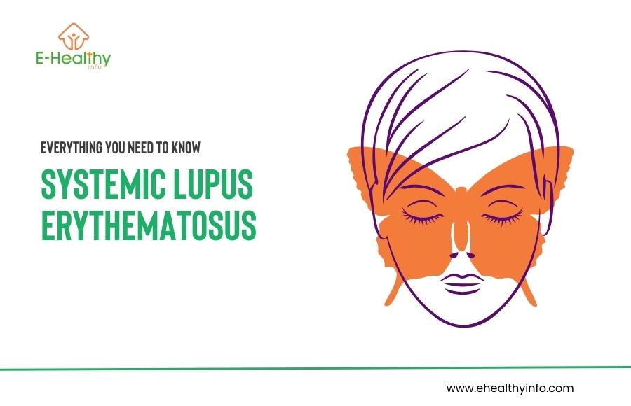 Understanding Lupus: Causes, Symptoms, and Treatment Options