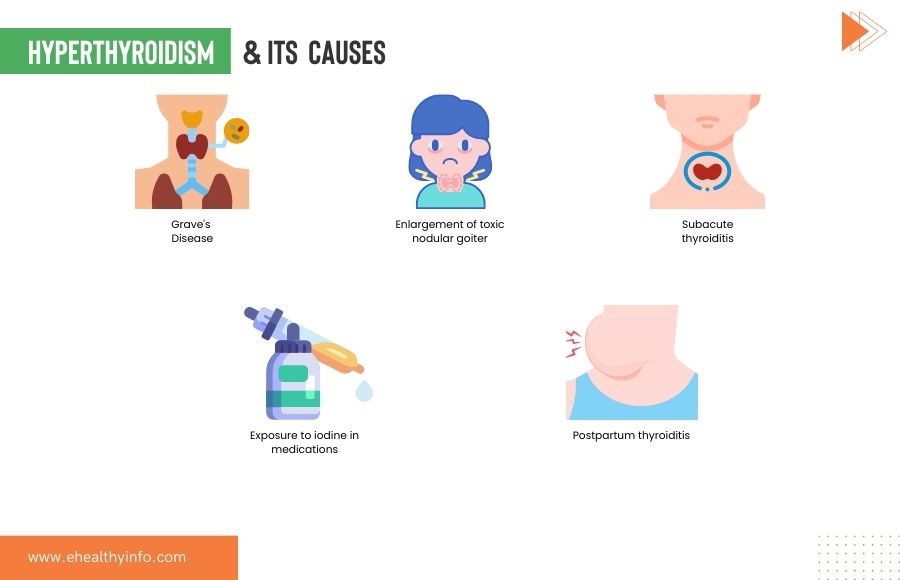 Causes of Hyperthyroidism