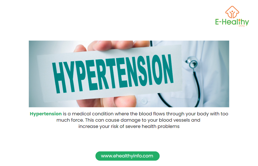 Hypertension (High blood pressure)