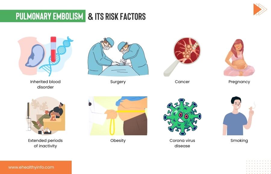 Pulmonary Embolism Risk Factors