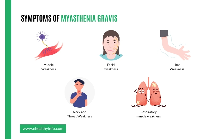 myasthenia gravis symptoms
