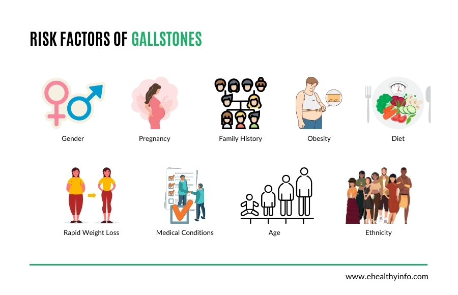 gallstones risk factors