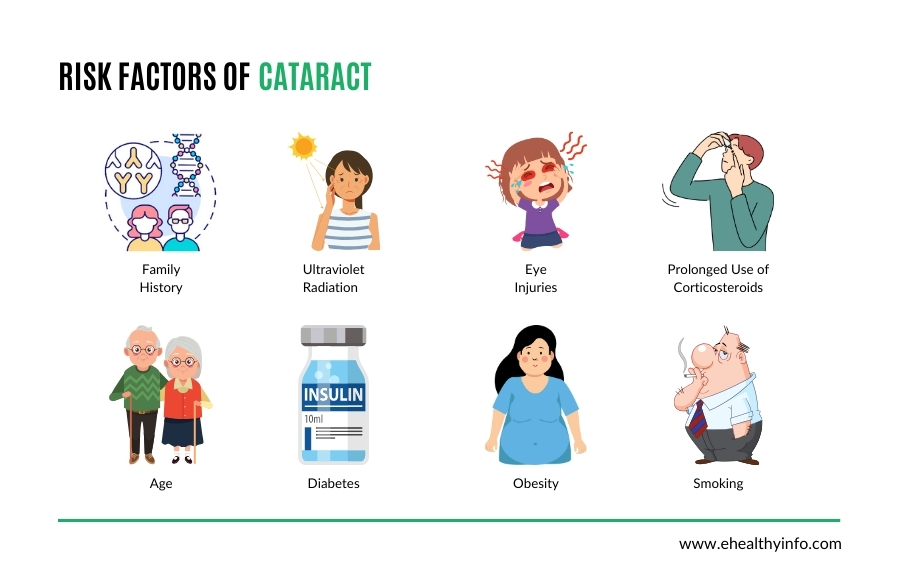 What are the risk factors of cataracts?
