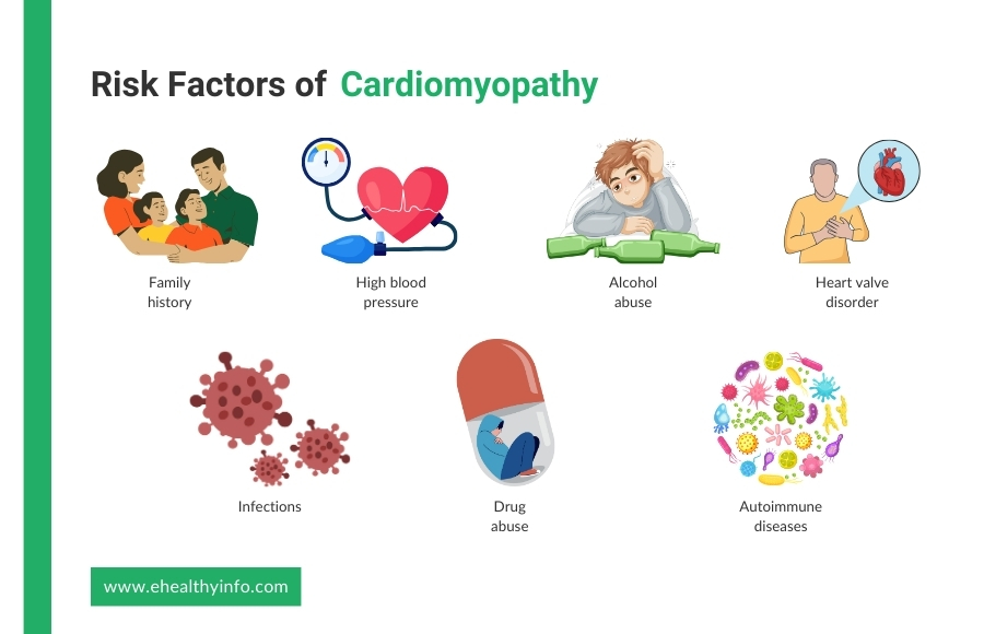 cardiomyopathy risk factors