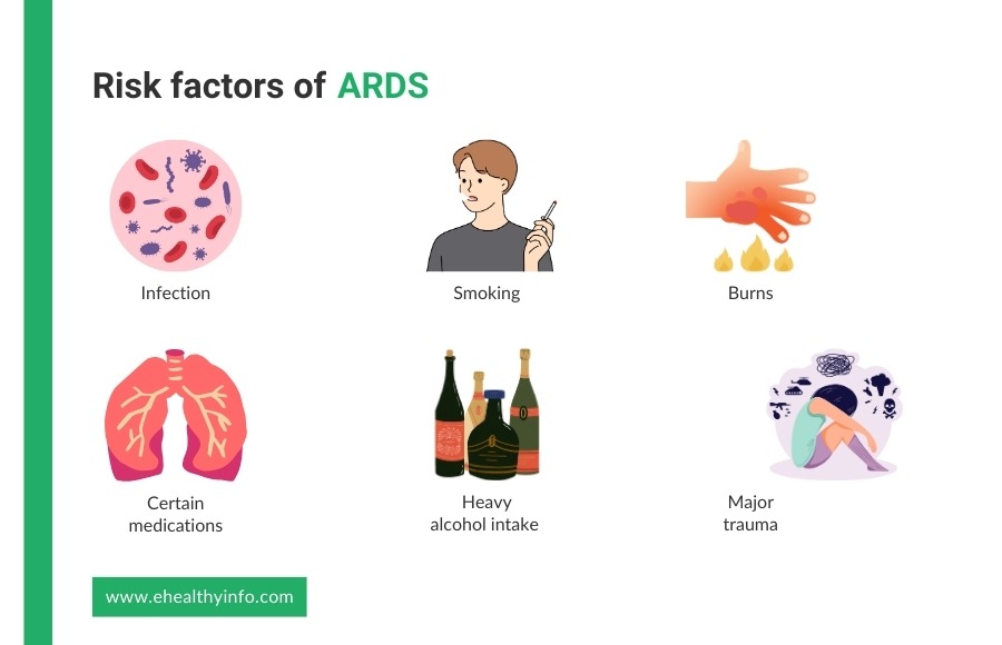 ARDS Risk Factors