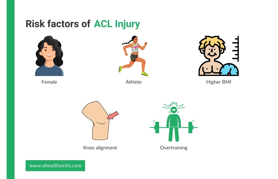 Risk Factors of ACL Injury