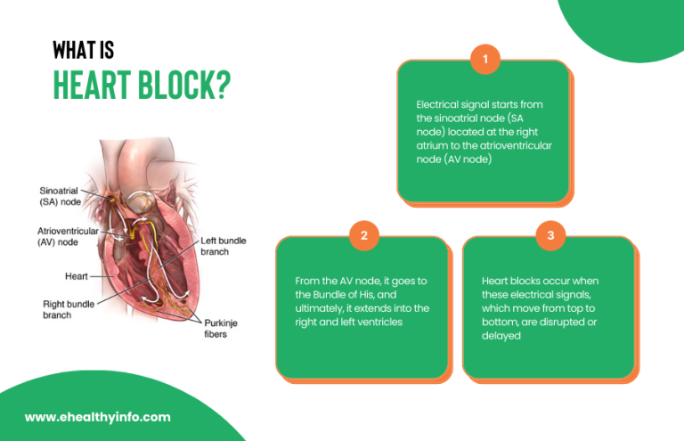 heart-block-types-causes-symptoms-and-treatment-options-e-healthy