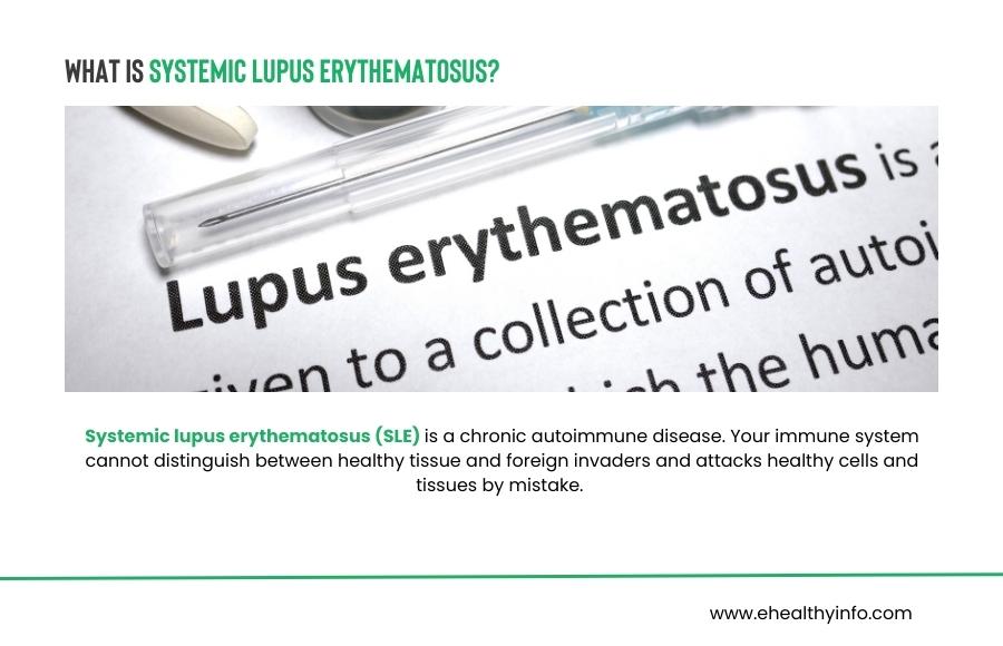 What Is Systemic Lupus Erythematosus(Lupus)