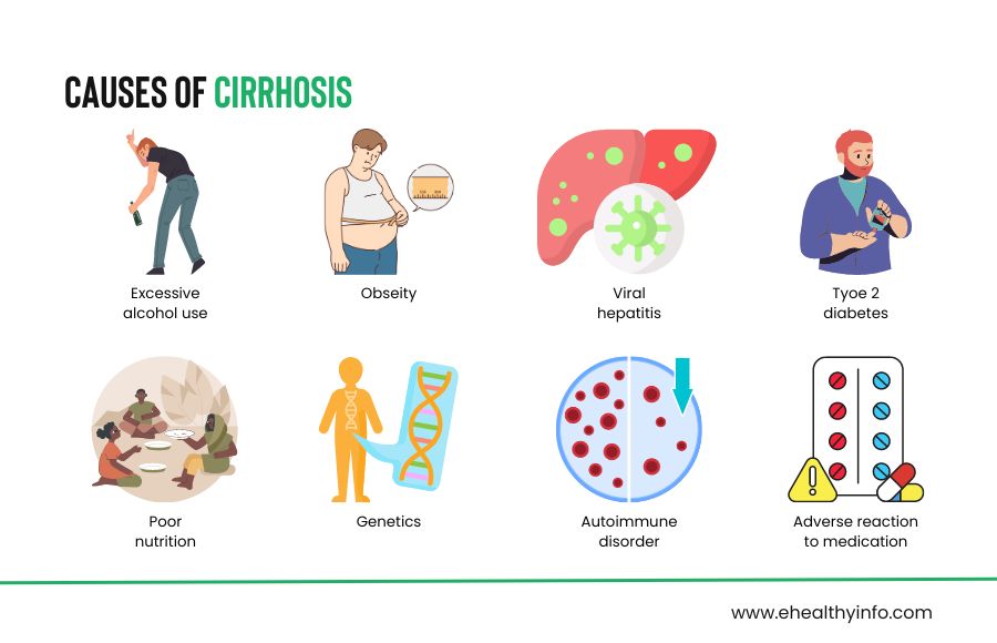 Liver cirrhosis causes