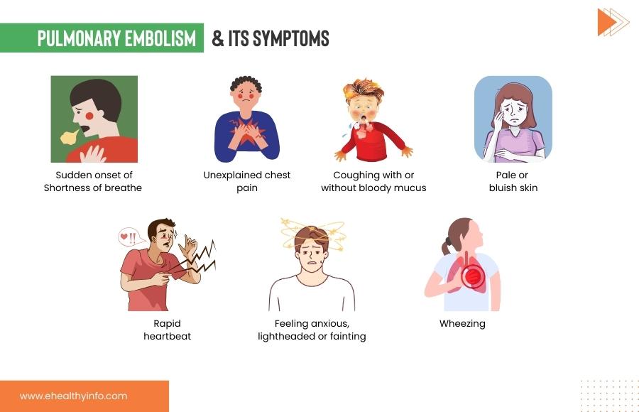 Pulmonary Embolism Symptoms