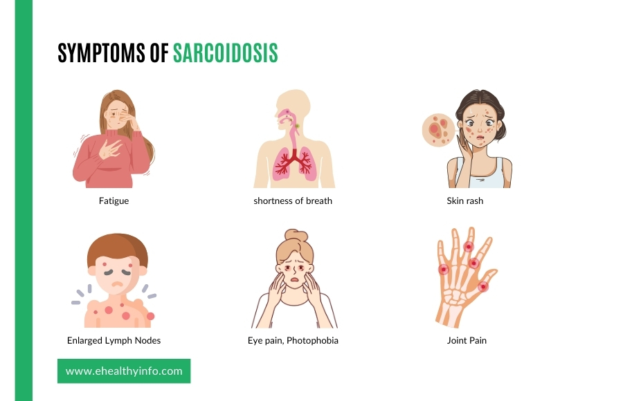 sarcoidosis symptoms