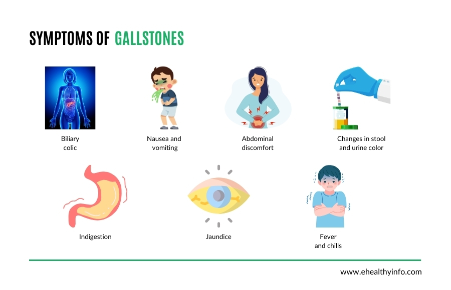 gallstones symptoms