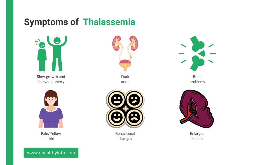 thalassemia symptoms