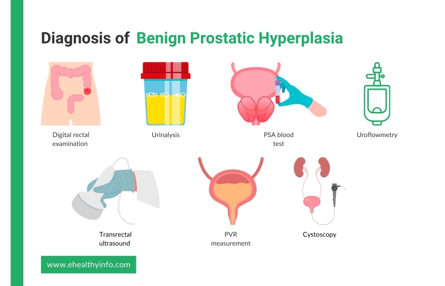 diagnosis of bph