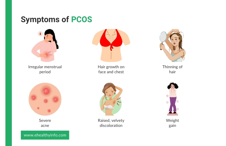 polycystic ovary syndrome symptoms