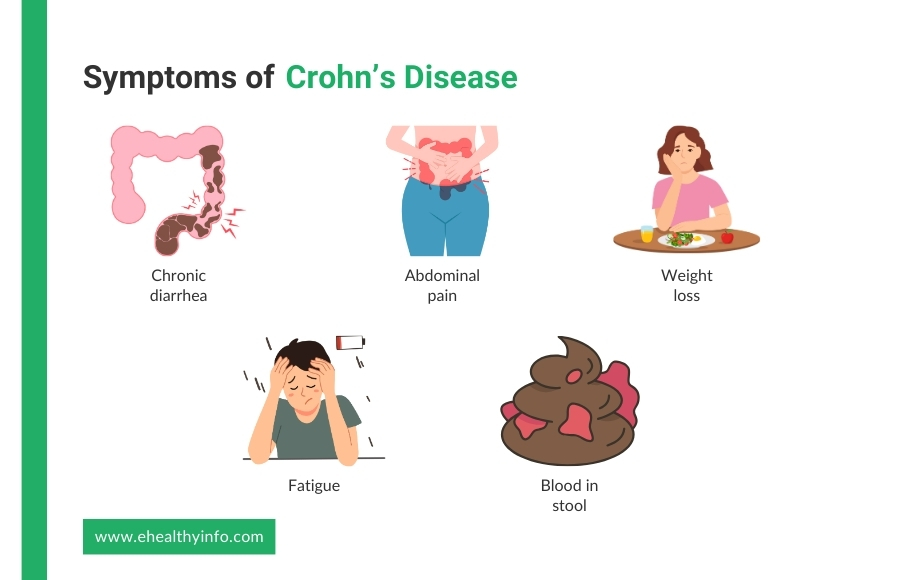 what are the symptoms of crohn's disease?