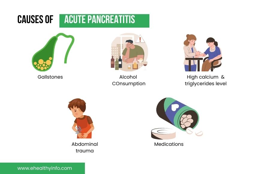 Causes of acute pancreatitis