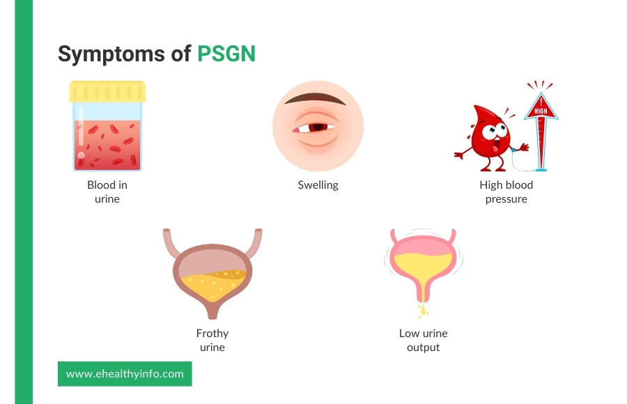 Symptoms of PSGN