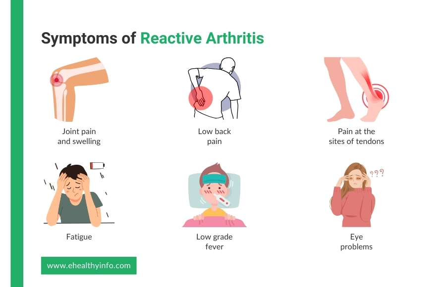 Symptoms of Reactive Arthritis