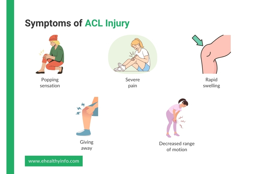 Symptoms of ACL Injury