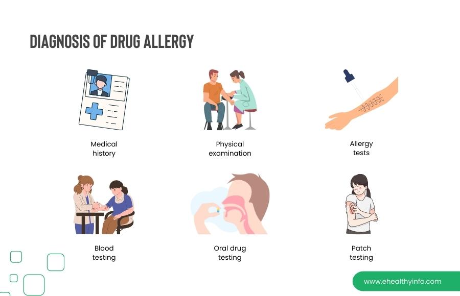 Diagnosis of drug allergy