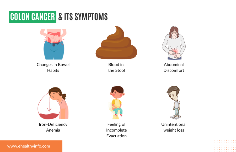Colon Cancer Symptoms