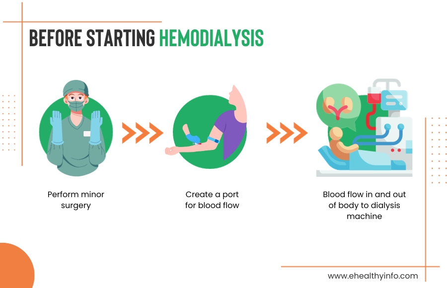 Hemodialysis Procedure