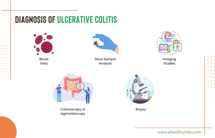 Ulcerative Colitis Diagnosis