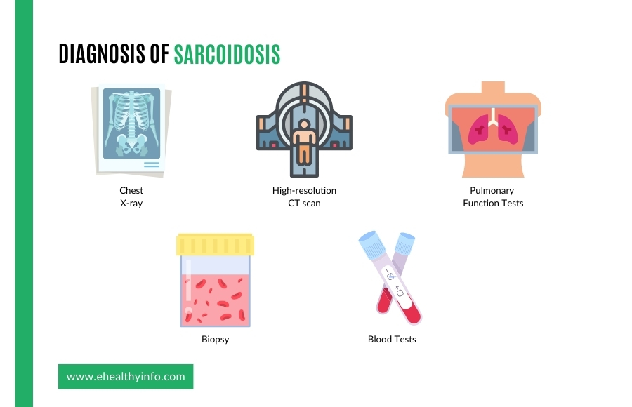 sarcoidosis diagnosis