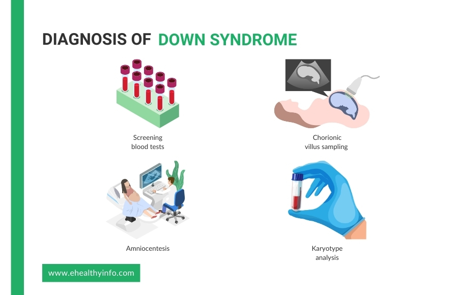 Down Syndrome Diagnosis