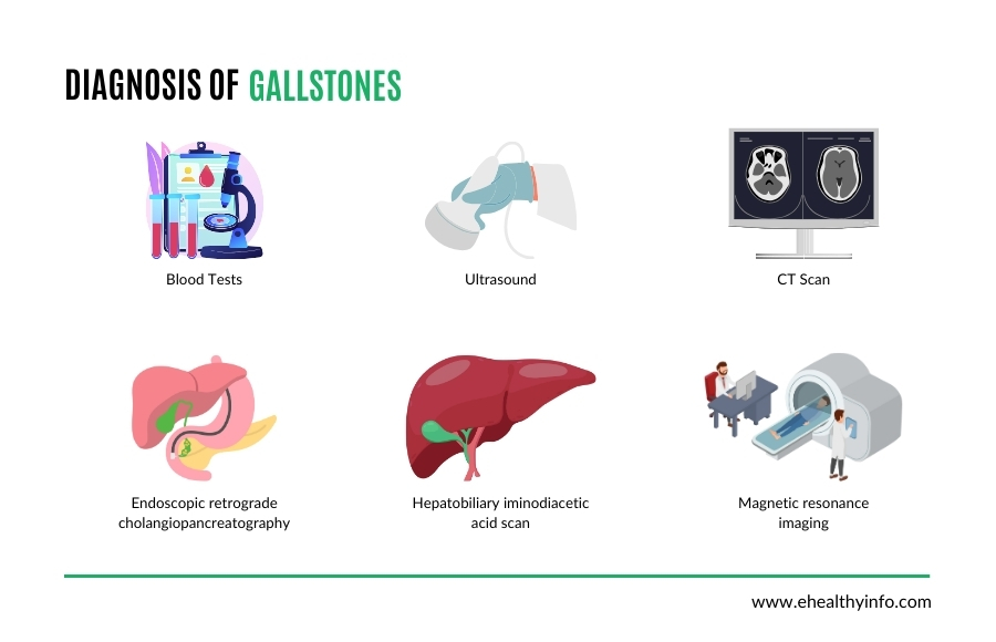 gallstones diagnosis
