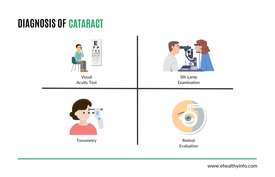 Diagnosis of cataract