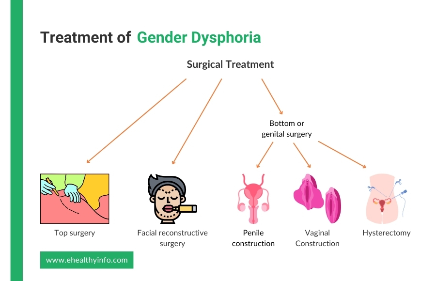 gender dysphoria treatment