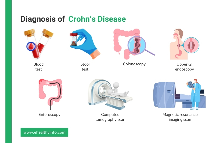 how is crohn's disease diagnosed?