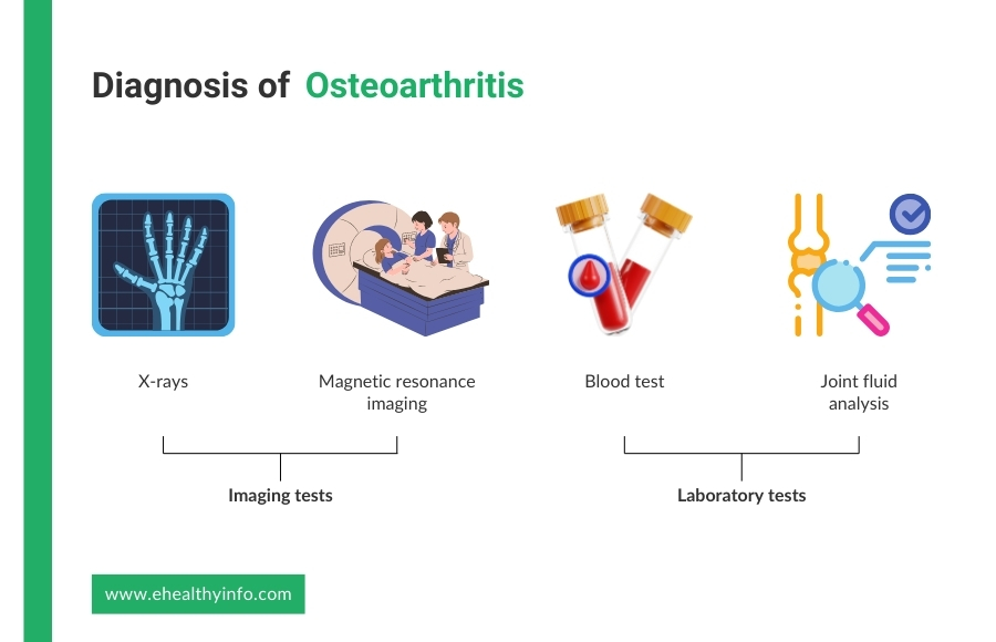 diagnosis of osteoarthritis