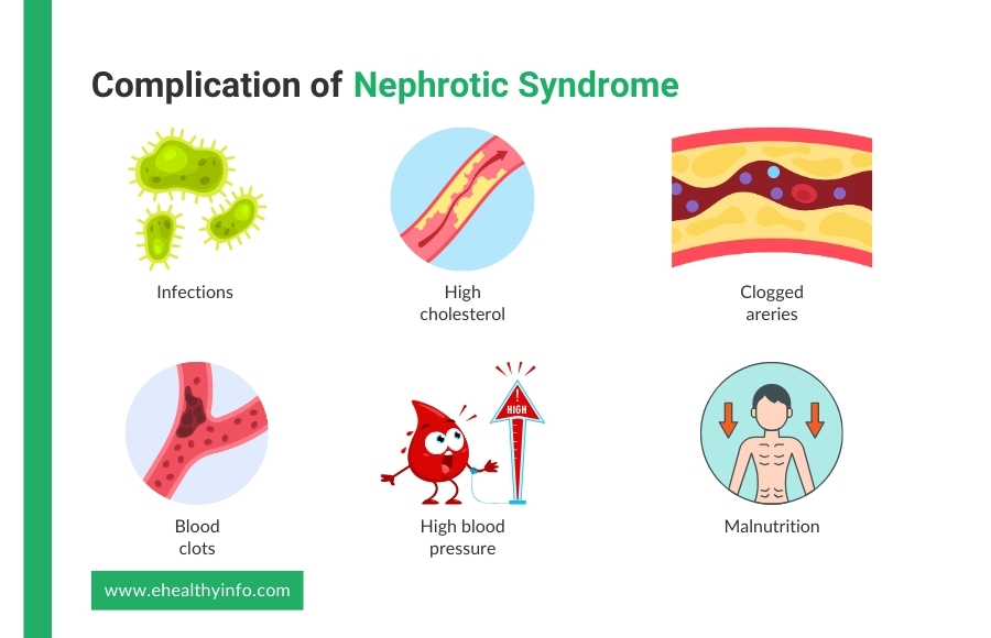 complications/effects of nephrotic syndrome