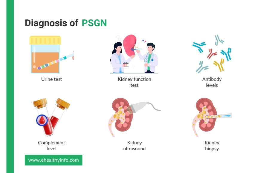 Diagnosis of PSGN