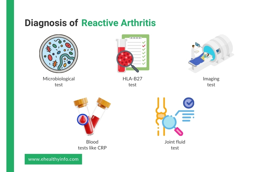 Diagnosis of Reactive Arthritis