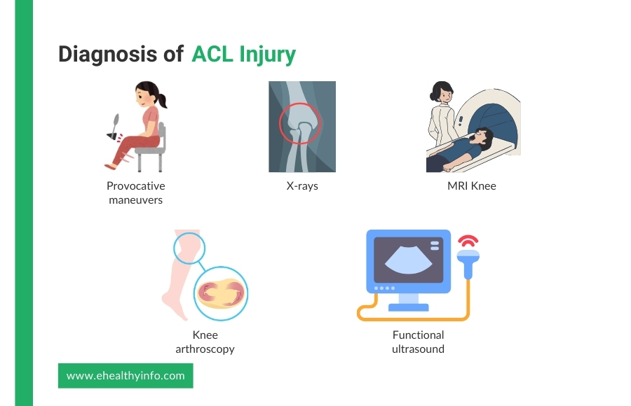 Diagnosis of ACL Injury