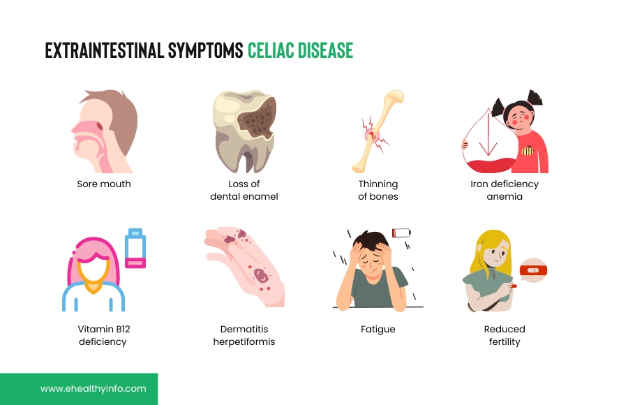 Extraintestinal Symptoms